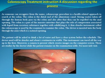 Colonoscopy Treatment instruction A discussion regarding the process