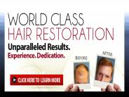 Hair Loss Restoration Products