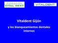 Vitaldent Gijón y los blanqueamientos dentales internos PowerPoint PPT Presentation