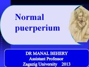 Puerperium. puerperal  fever ,and puerperal sepsis for undergraduate