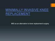 MINIMALLY INVASIVE KNEE REPLACEMENT