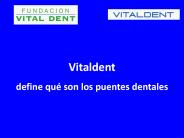 Vitaldent define qué son los puentes dentales