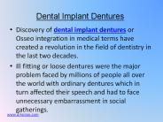 Dental Implant Dentures 12-17