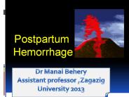 Postpartum hemorrhage