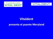 Vitaldent presenta el puente Meryland