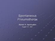 Spontaneous Pneumothorax