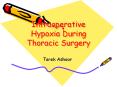 Intraoperative Hypoxia During Thoracic Surgery PowerPoint PPT Presentation