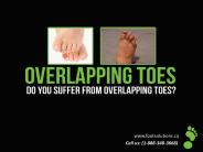 Overlapping Toes