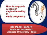 CASE STUDY ON EARLY PREGNANCY BLEEDING FOR UNDERGRADUATE