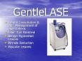 GentleLASE PowerPoint PPT Presentation