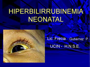 HIPERBILIRRUBINEMIA NEONATAL