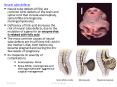 Neural tube defects PowerPoint PPT Presentation