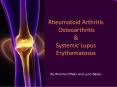 Rheumatoid Arthritis Osteoarthritis PowerPoint PPT Presentation