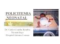 POLICITEMIA NEONATAL PowerPoint PPT Presentation