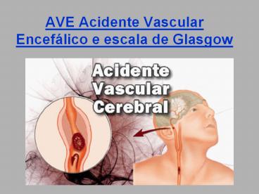 AVE Acidente Vascular Encef