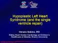 Hypoplastic Left Heart Syndrome (and the single ventricle repair) PowerPoint PPT Presentation