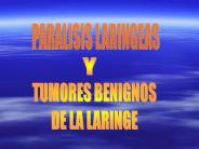 TUMORES BENIGOS DE LA LARINGE
