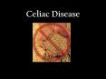 Celiac Disease PowerPoint PPT Presentation