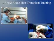 Know about hair transplant
