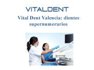 Vital Dent Valencia: dientes supernumerarios