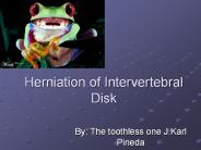 Herniation of Intervertebral Disk