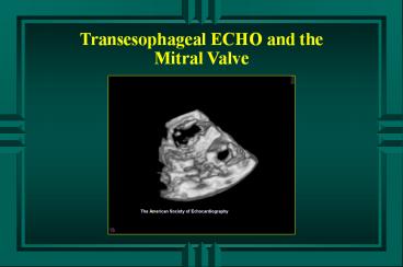 Transesophageal ECHO and the  Mitral Valve