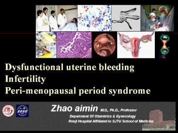 Dysfunctional uterine bleeding Infertility Peri-menopausal period syndrome