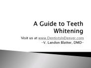 A Guide to Teeth Whitening