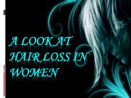 A Look at Hair Loss in Women