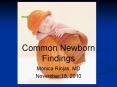 Common Newborn Findings PowerPoint PPT Presentation
