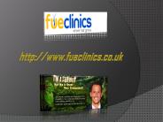 Hair Loss Treatment