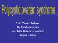 Polycystic ovary syndrome PowerPoint PPT Presentation