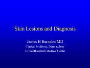 Skin Lesions and Diagnosis