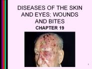 DISEASES OF THE SKIN AND EYES; WOUNDS AND BITES
