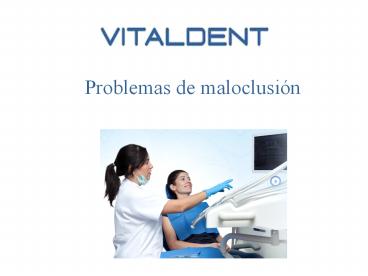 Vital Dent Mérida: maloclusiones