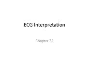 ECG Interpretation