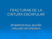 FRACTURAS DE LA CINTURA ESCAPULAR