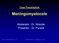 Case Presentation Meningomyelocele PowerPoint PPT Presentation