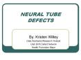 NEURAL TUBE DEFECTS PowerPoint PPT Presentation
