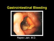 Gastrointestinal Bleeding