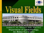 Visual Fields in Glaucoma