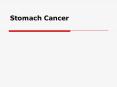 Stomach Cancer PowerPoint PPT Presentation