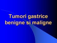 Tumori gastrice benigne si maligne