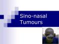 Sino-nasal Tumours PowerPoint PPT Presentation