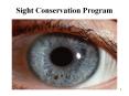 Sight Conservation Program PowerPoint PPT Presentation