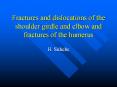 Fractures and dislocations of the shoulder girdle and elbow and fractures of the humerus PowerPoint PPT Presentation