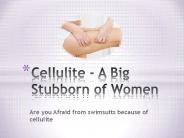 Cellulite - A Big Stubborn of Women