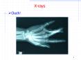 X-rays PowerPoint PPT Presentation