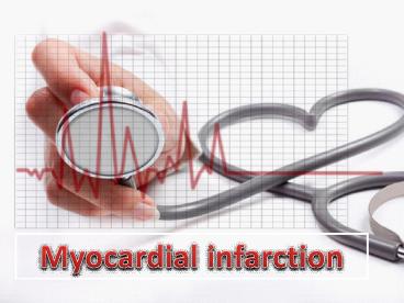 Myocardial infarction