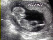 HIJO MIO